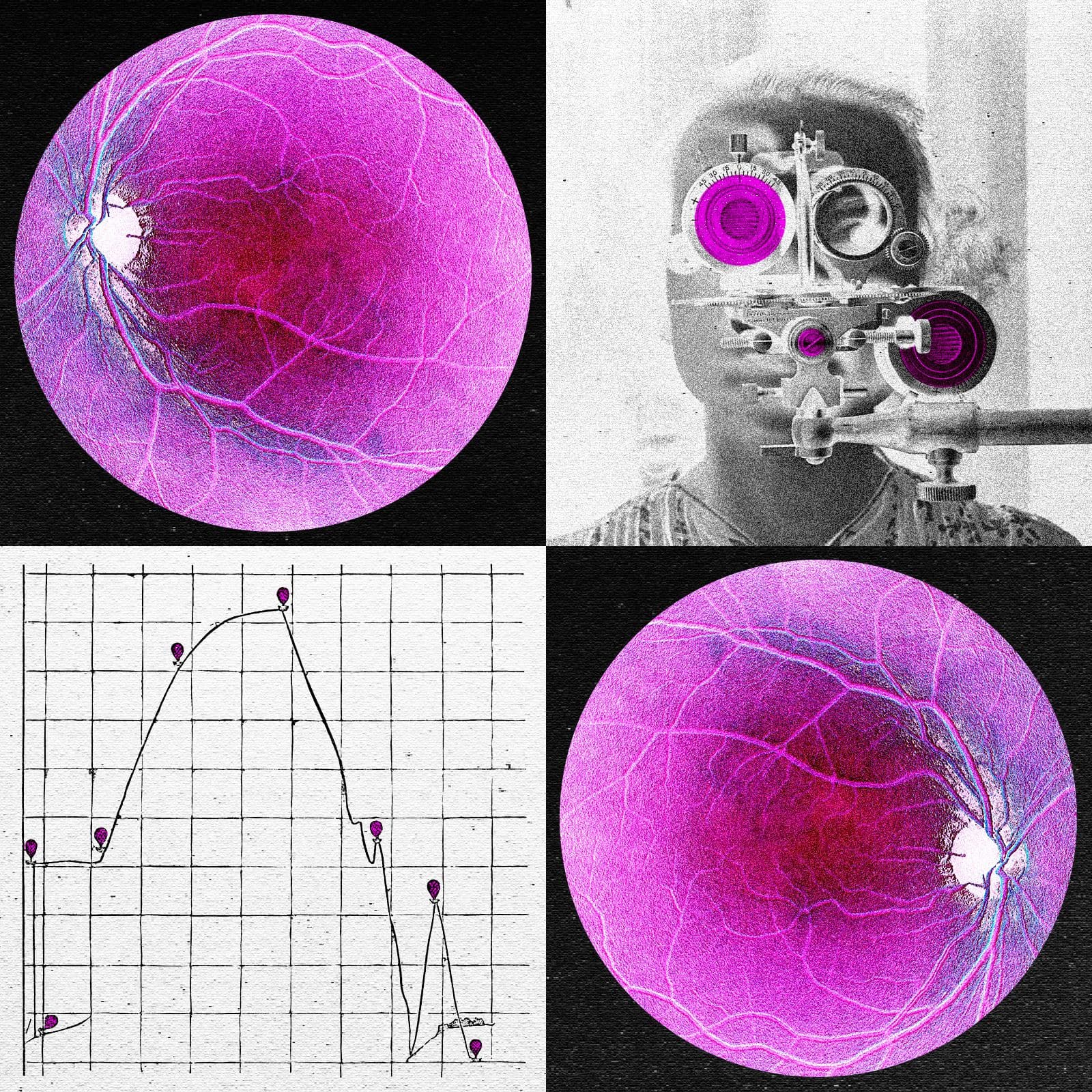 Longevity Startup Doses First Human in Bid to Reverse Age-Related Sight Loss