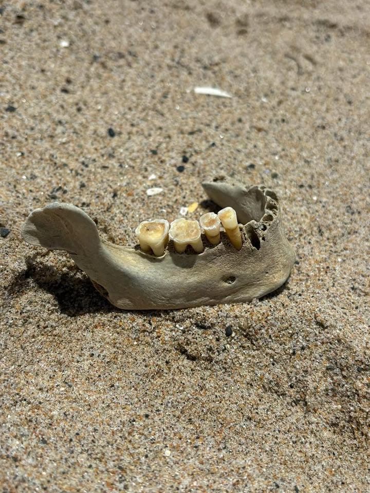 SoCal beachgoer makes horrifying discovery in sand