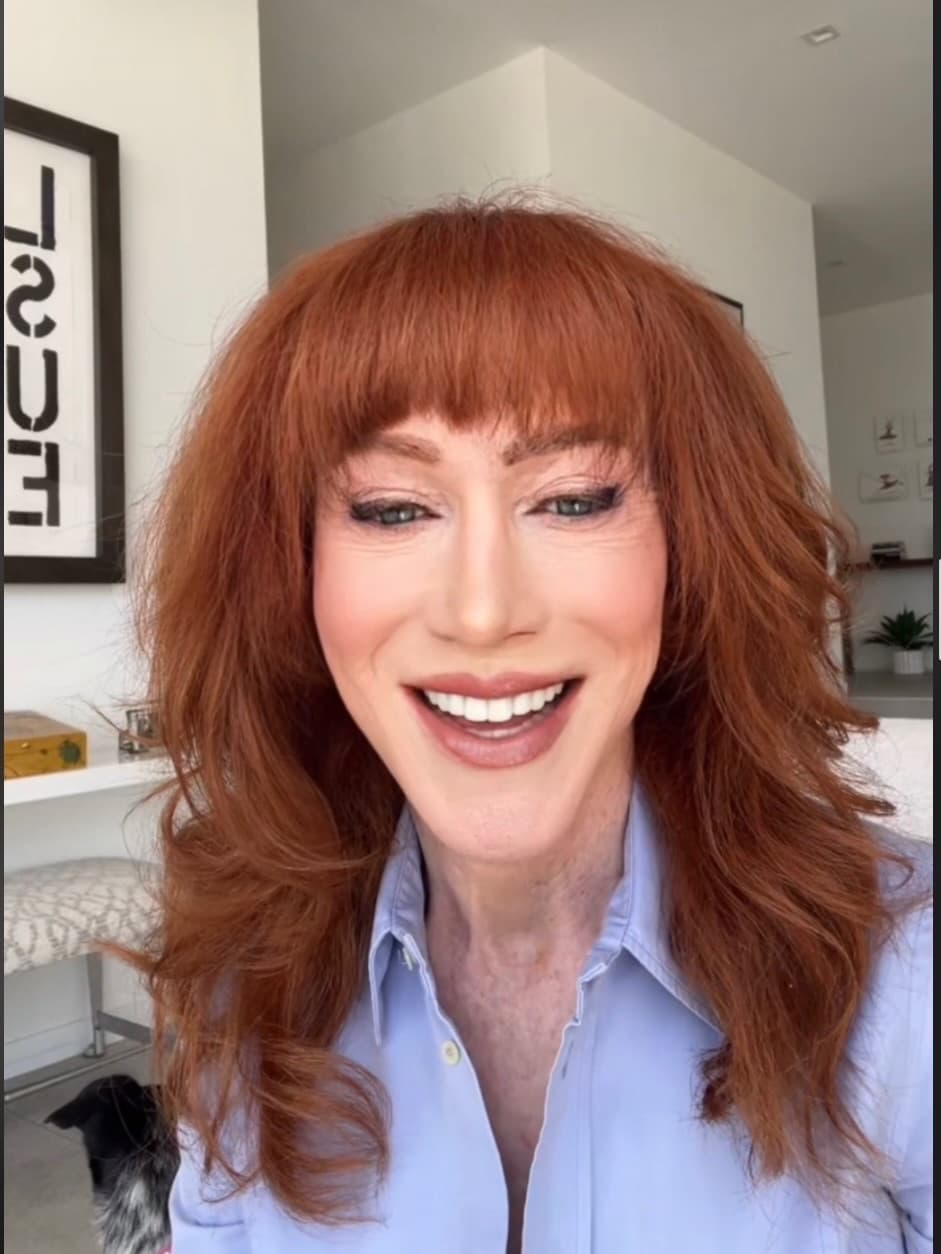 Kathy Griffin reveals she was hospitalized over colonoscopy complications in ‘TMI’ health update
