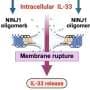 Dying cells don't all release key inflammatory cytokine in the same way, research reveals
