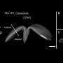 Leaf forces help steer stomata as young plants grow, experiments reveal