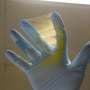 Nanofiber implant delivers three drugs, doubles survival in glioblastoma mice