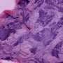 New 3D microscope technology captures high-resolution tissue images at a fraction of the cost