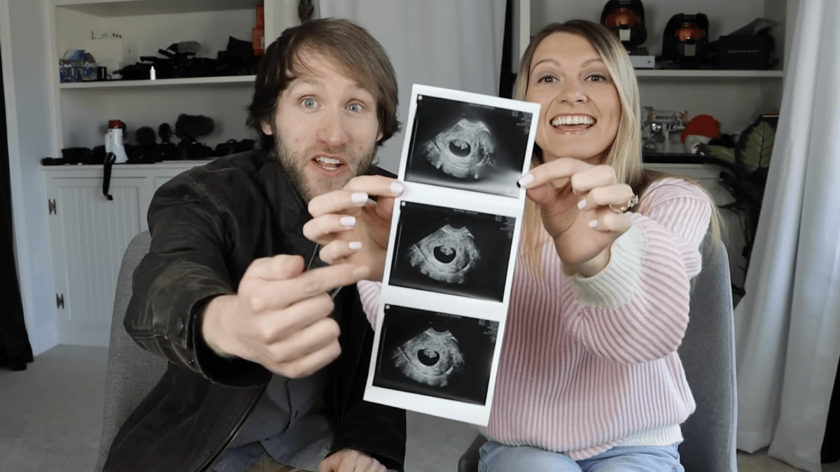 Media Shrug At Aborting Down Syndrome Baby But Cry ‘Eugenics’ At Sydney Sweeney’s Cup Size