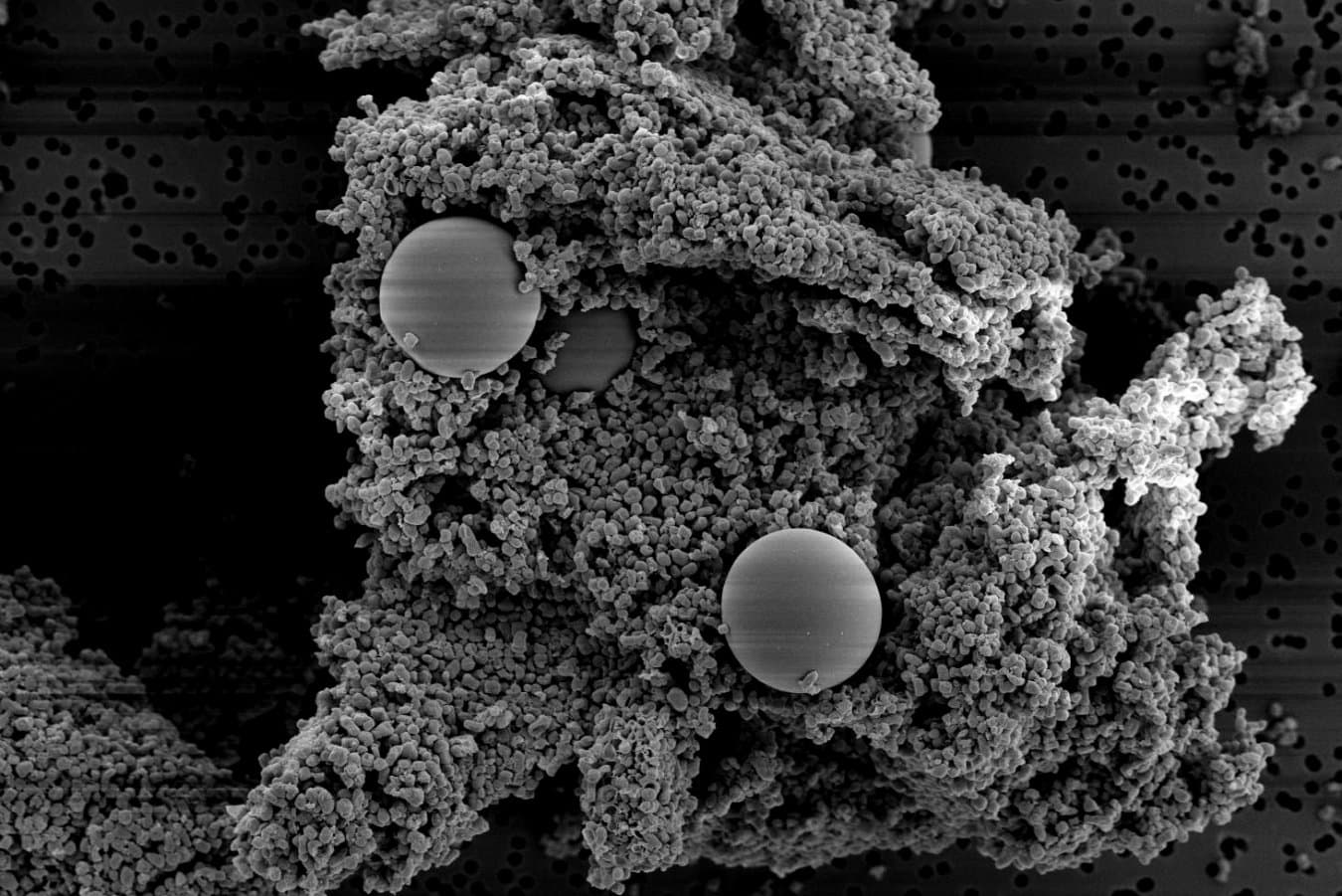 Supplement that binds to microplastics may remove them from our body