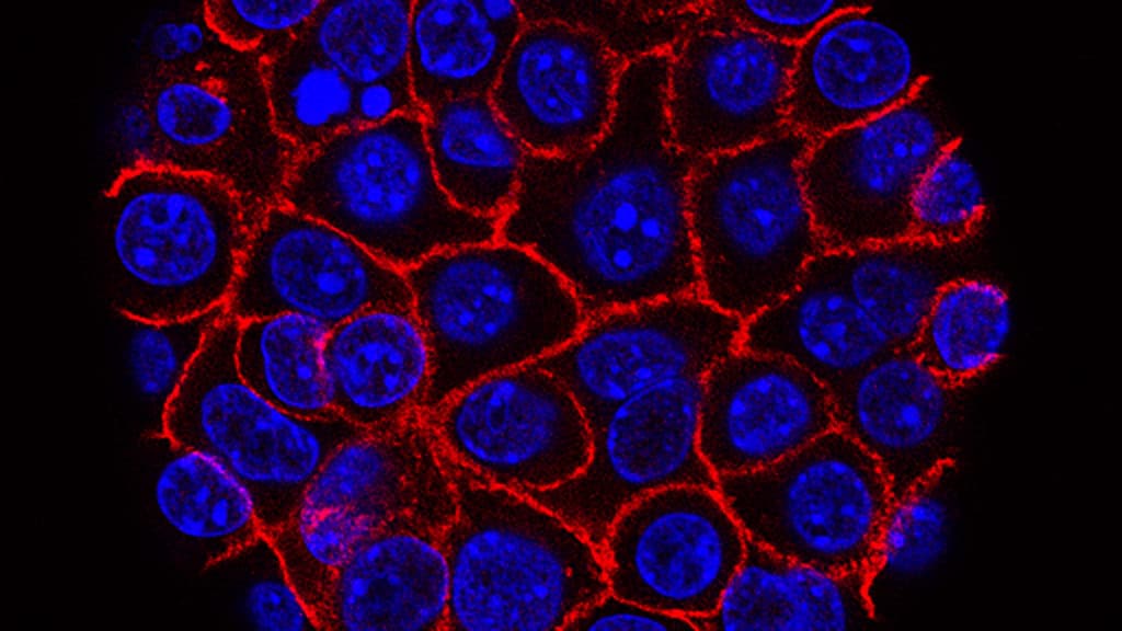 STAT+: Combination of pancreatic cancer drugs from Tango, Revolution leads to high response rate