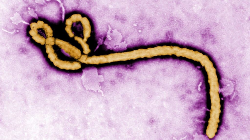 The latest developments on Ebola, hepatitis B, long Covid