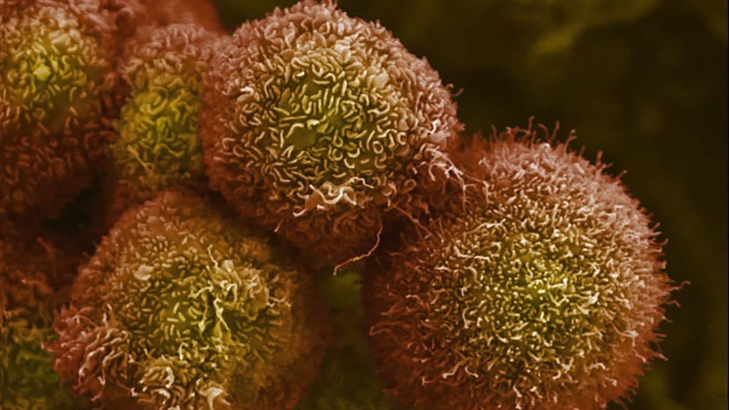 STAT+: Revolution Medicines touts ‘unprecedented’ data for pancreatic cancer pill