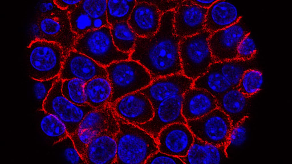 STAT+: ‘Synthetic lethality’ could trigger another round of biotech M&A