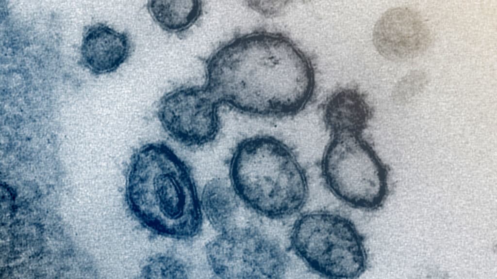Opinion: How long Covid’s scientific stalemate made it politically erasable
