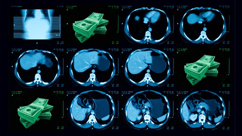 STAT+: AI could check millions of CT scans for heart risk. Who will pay for it?