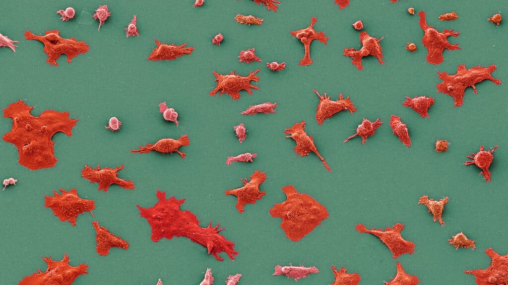 STAT+: Practice-changing results reported for Revolution Medicines pancreatic cancer drug